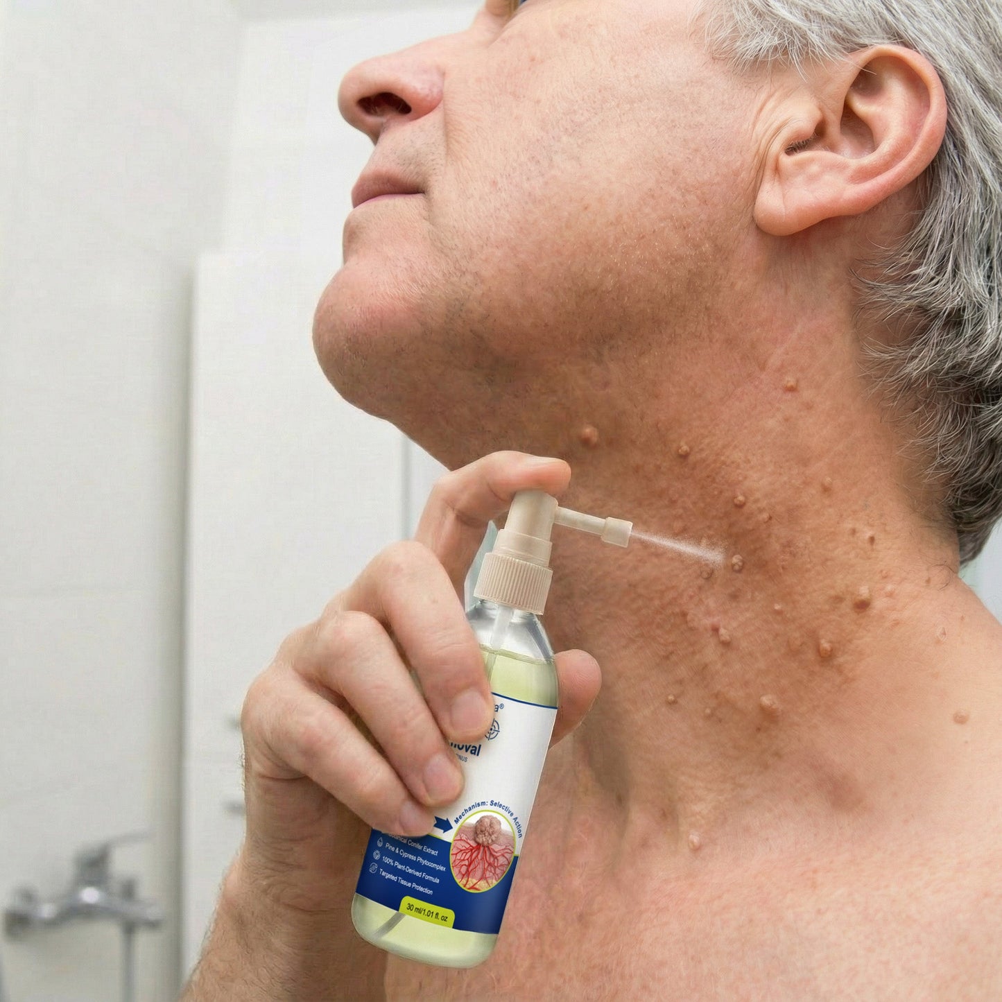 💖💥Celsiora® Targeted Wart & Skin Tag Removal Spray – Time-Released Phyto-Exfoliant (12% White Willow) & Bio-Active Terpene Viral-Inhibitor (8% Thuja)