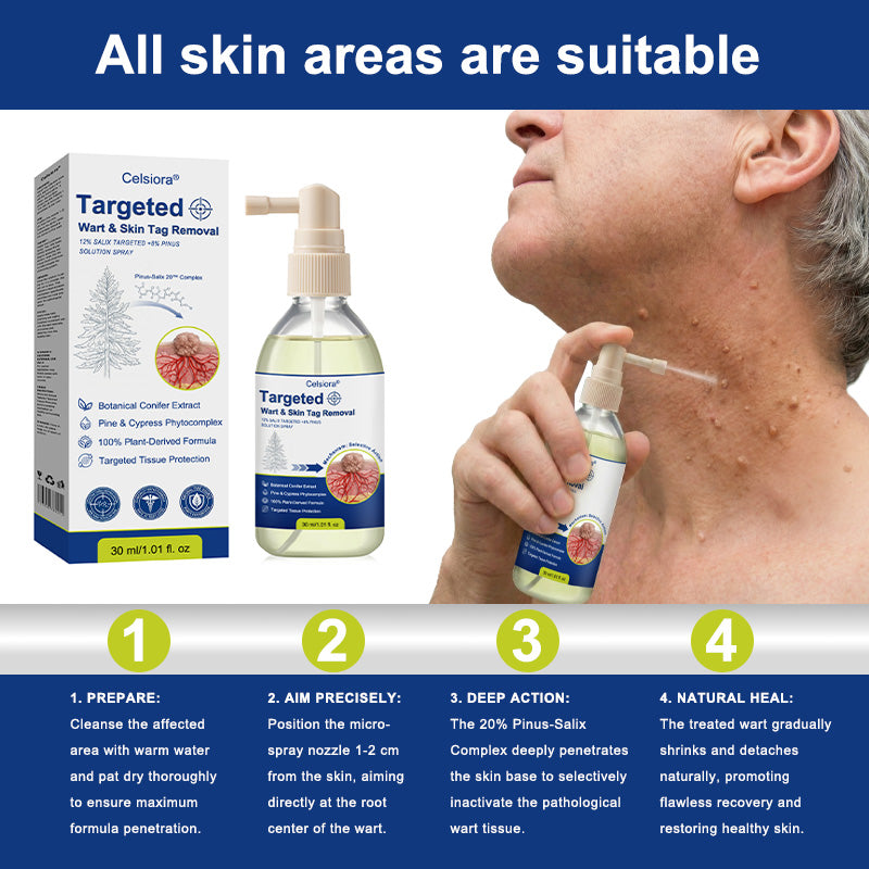💖💥Celsiora® Targeted Wart & Skin Tag Removal Spray – Time-Released Phyto-Exfoliant (12% White Willow) & Bio-Active Terpene Viral-Inhibitor (8% Thuja)