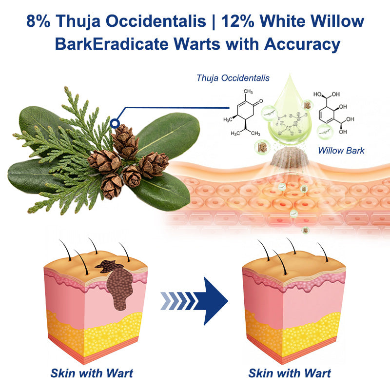 💖💥Celsiora® Targeted Wart & Skin Tag Removal Spray – Time-Released Phyto-Exfoliant (12% White Willow) & Bio-Active Terpene Viral-Inhibitor (8% Thuja)