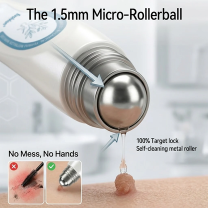 💖✨Evolvion® 𝟕-𝐃𝒂𝘆 𝐒𝗸𝐢𝐧 𝐓𝒂𝗴 & 𝐒𝐩𝙤𝐭 𝐄𝐫𝒂𝐬𝙚𝐫 Painless & Scar-Free Advanced Imperfection Remova𝗜 Ro𝗜𝗜erba𝗜𝗜 Pen 🌿